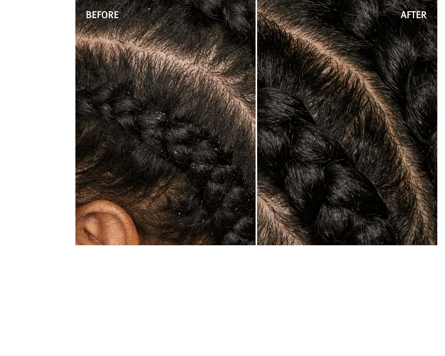 Voyez la différence lors de l’utilisation de scalp solutions