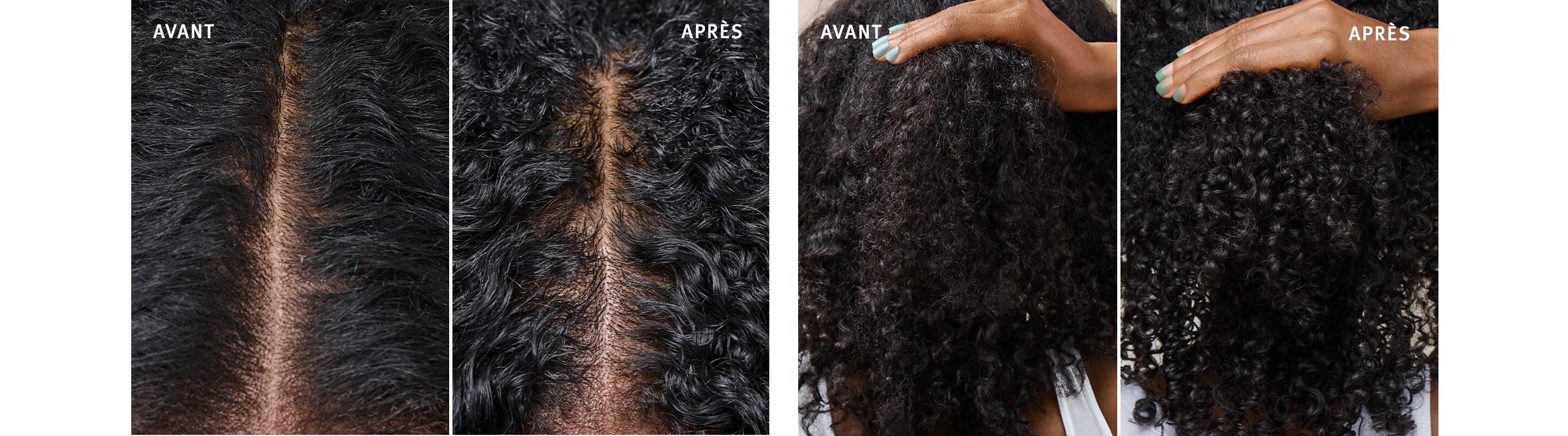 Voyez la différence lors de l’utilisation de scalp solutions