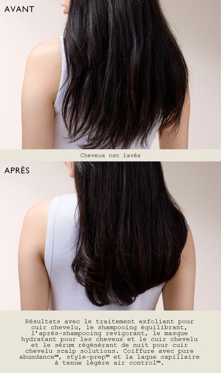 masque hydratant pour le cuir chevelu et les cheveux scalp solutions