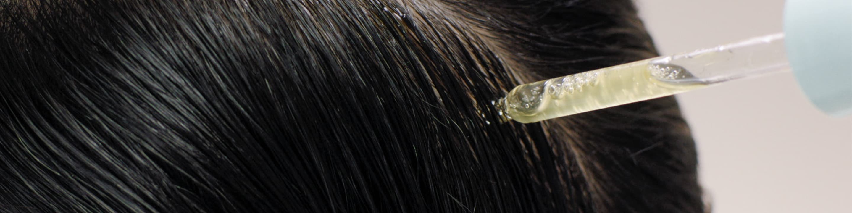 Un cuir chevelu sain pour des cheveux sains.