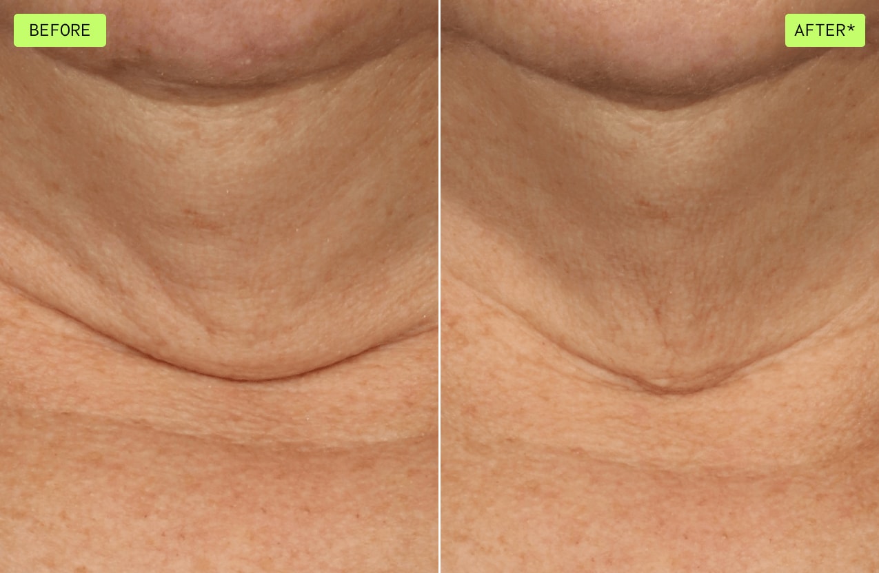 Voyez la différence lors de l’utilisation de botanical repair